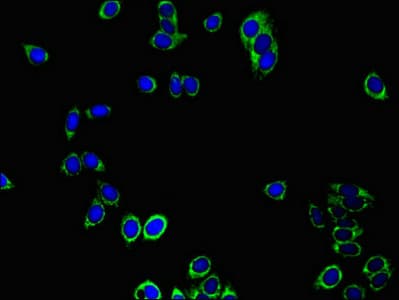 Polyclonal Rabbit anti-Human PRDX3 / Peroxiredoxin 3 Antibody (IHC, IF, WB)