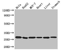 Polyclonal Rabbit anti-Human PRDX3 / Peroxiredoxin 3 Antibody (IHC, IF, WB)
