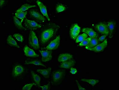 PSMC3 Antibody