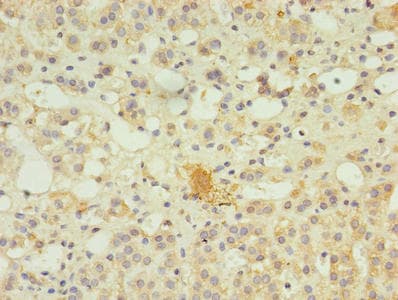 SERPINB8 Antibody