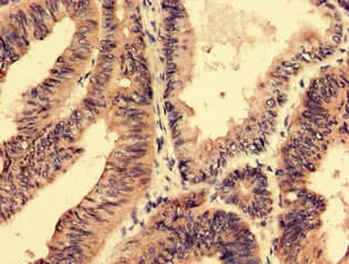 Polyclonal Rabbit anti-Human SFRP4 Antibody