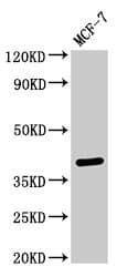 Polyclonal Rabbit anti-Human SFRP4 Antibody