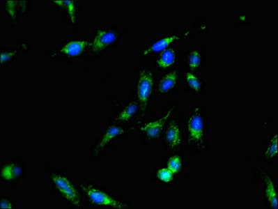 Polyclonal Rabbit anti-Human SMS / Spermine Synthase Antibody (IHC, IF)