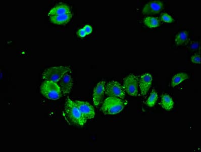 Polyclonal Rabbit anti-Human SPRY2 / Sprouty 2 Antibody (IHC, IF, WB)