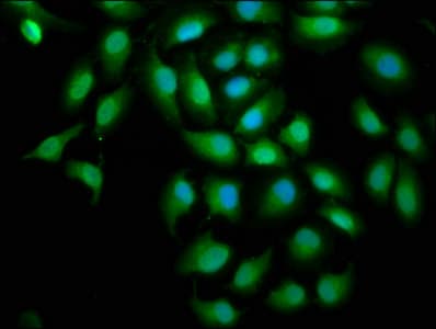 Polyclonal Rabbit anti-Human SREBF1 / SREBP-1 Antibody (IHC)