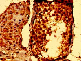 Polyclonal Rabbit anti-Human STAT5B Antibody (IHC, IF, WB)