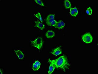 TMEM186 Antibody