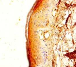 TMEM40 Antibody