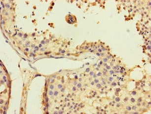 USP5 Antibody