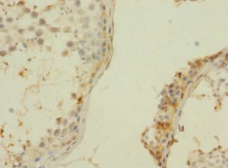 ZNF564 Antibody