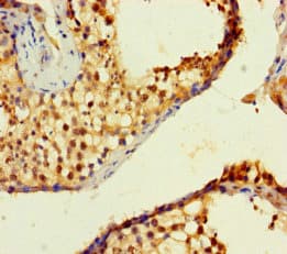 ZNF800 Antibody