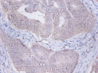 PRKCSH Antibody