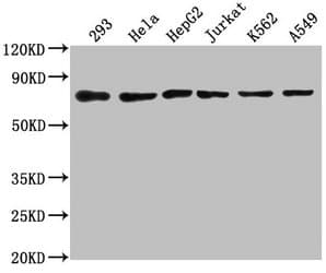 Polyclonal Rabbit anti-Human HSPA8 / HSC70 Antibody (IHC, WB)