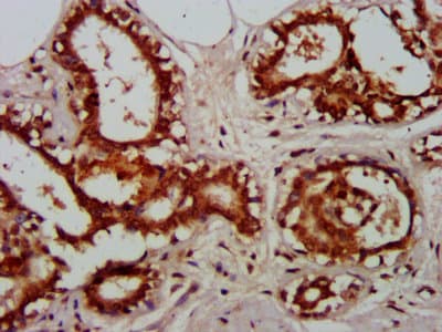 Polyclonal Rabbit anti-Human RELA / NFKB p65 Antibody