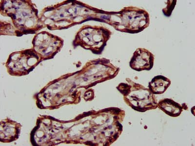 Polyclonal Rabbit anti-Human RELA / NFKB p65 Antibody