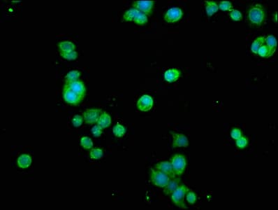 Polyclonal Rabbit anti-Human RELA / NFKB p65 Antibody