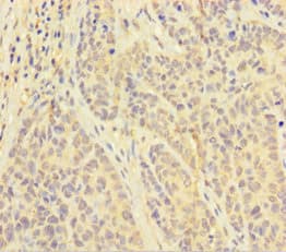 Polyclonal Rabbit anti-Human PAPPA / PAPP-A Antibody (WB)
