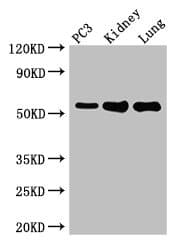 MMP13 Antibody