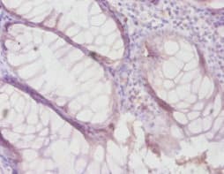Polyclonal Rabbit anti-Human TIMP4 Antibody (IHC)
