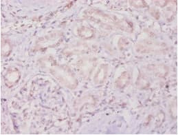 Polyclonal Rabbit anti-Human TIMP4 Antibody (IHC)