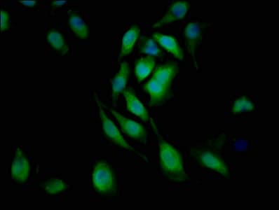 Polyclonal Rabbit anti-Human VCAM1 / CD106 Antibody (IHC, WB)