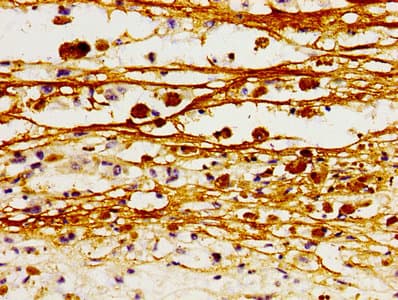 Polyclonal Rabbit anti-Human VCAM1 / CD106 Antibody (IHC, WB)