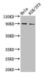 Polyclonal Rabbit anti-Human VCAM1 / CD106 Antibody (IHC, WB)