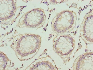 Polyclonal Rabbit anti-Human LP-PLA2 / PLA2G7 Antibody (WB)