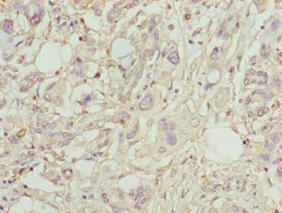 Polyclonal Rabbit anti-Human LP-PLA2 / PLA2G7 Antibody (WB)