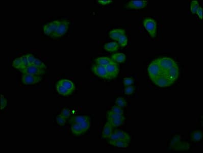 Polyclonal Rabbit anti-Human CTGF Antibody (WB)