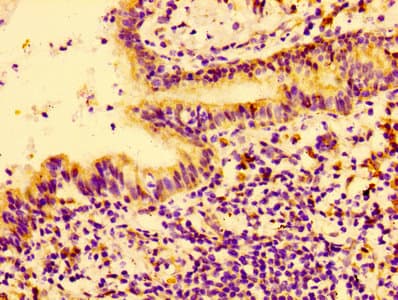 Polyclonal Rabbit anti-Human CTGF Antibody (WB)