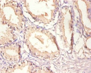 EGFR Antibody