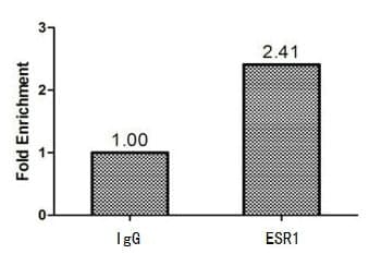 Polyclonal Rabbit anti-Human ER Alpha / Estrogen Receptor Antibody