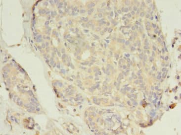 Polyclonal Rabbit anti-Human ER Alpha / Estrogen Receptor Antibody