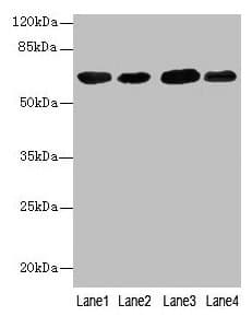 Polyclonal Rabbit anti-Human ER Alpha / Estrogen Receptor Antibody