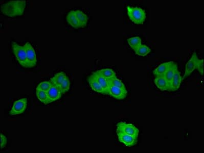Polyclonal Rabbit anti-Human REN / Renin 1 Antibody (IF, WB)