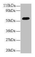 Polyclonal Rabbit anti-Human ICA69 / ICA1 Antibody (IHC, WB)