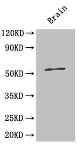 Polyclonal Rabbit anti-Human ICA69 / ICA1 Antibody (IHC, WB)