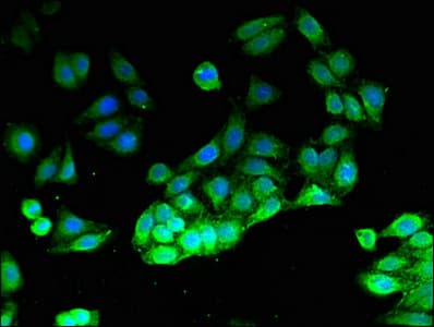 Polyclonal Rabbit anti-Human PIK3CG / PI3K Gamma Antibody (IF)