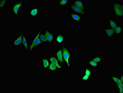 Polyclonal Rabbit anti-Human STAU1 / Staufen Antibody (IHC, IF, WB)