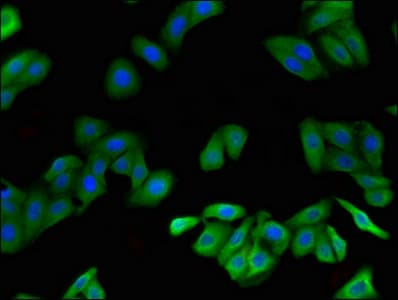 Polyclonal Rabbit anti-Human FGF23 Antibody (IF)