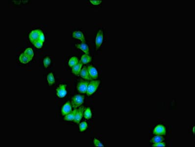 Polyclonal Rabbit anti-Human RALDH2 / ALDH1A2 Antibody (WB)
