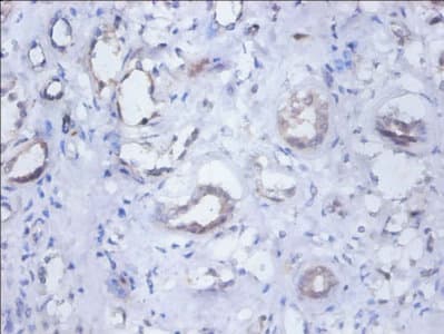 Polyclonal Rabbit anti-Human RALDH2 / ALDH1A2 Antibody (WB)
