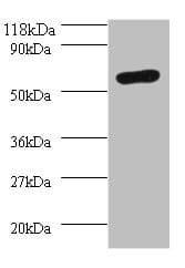Polyclonal Rabbit anti-Human RALDH2 / ALDH1A2 Antibody (WB)