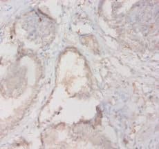 HLA-DQA2 Antibody