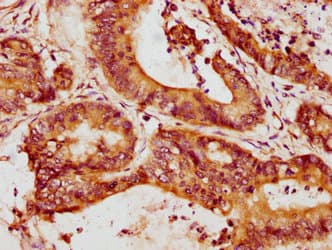 Polyclonal Rabbit anti-Mouse MMP13 Antibody (WB)