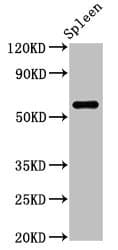 RBMY1A1 Antibody