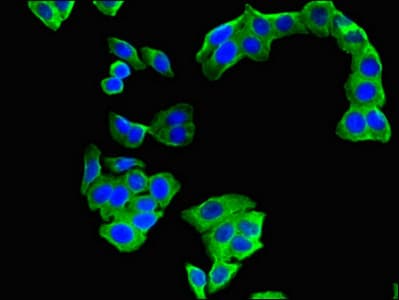 ARPP19 Antibody