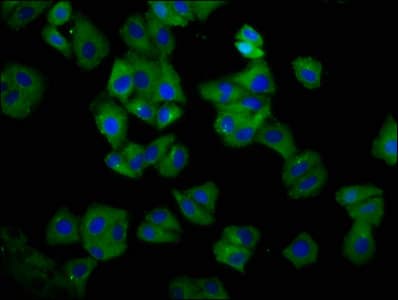HLA Class I Histocompatibility Antigen, C-4 Alpha Chain Antibody