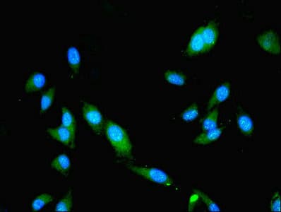 SLA Antibody
